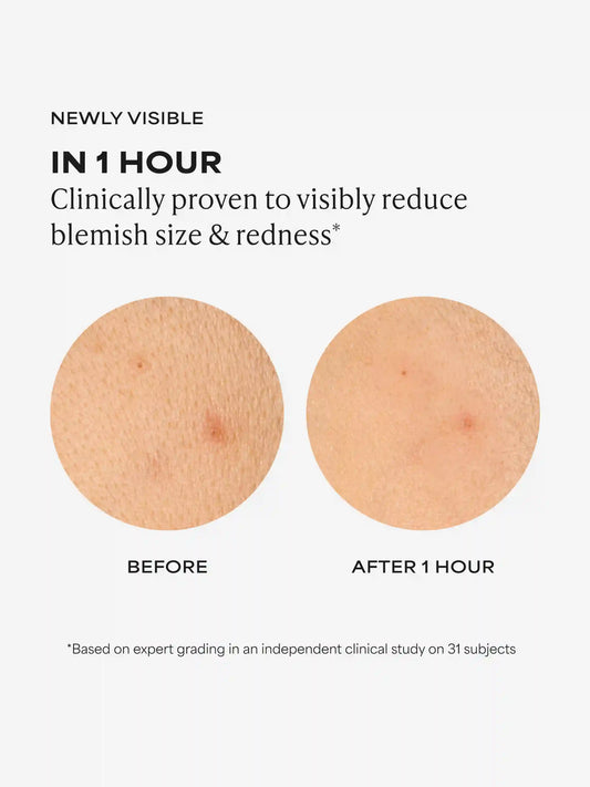 Clear Quick Rescue Blemish Hydrocolloid Patches