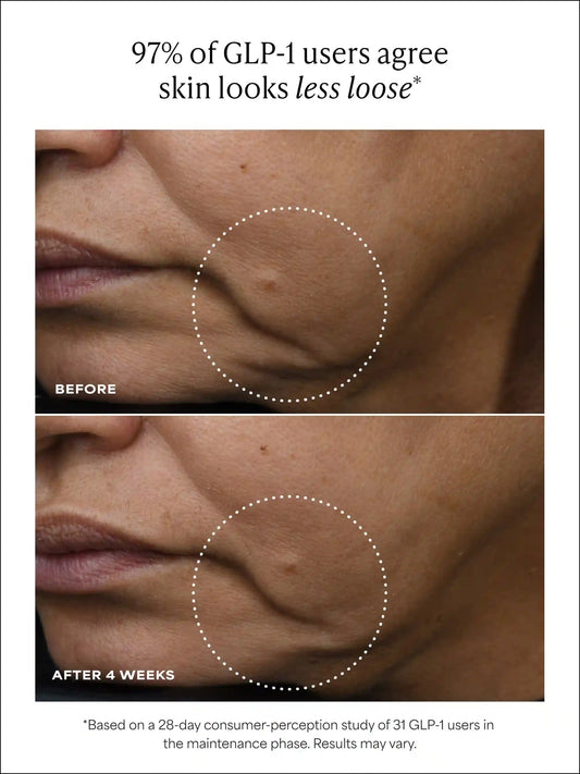 PRO Retinaldehyde Dual-Retinoid Treatment